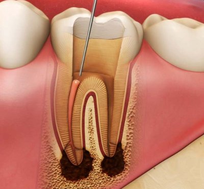 Dental Examination